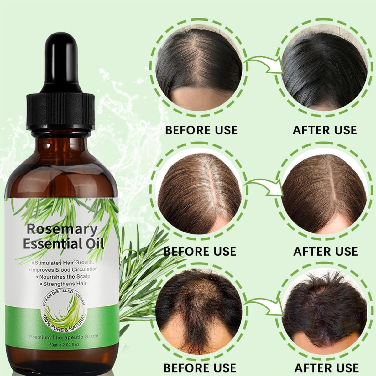 Rosmarinöl 180ml für Haarwachstum Set Hautpflege Natürlich gegen Haarausfall