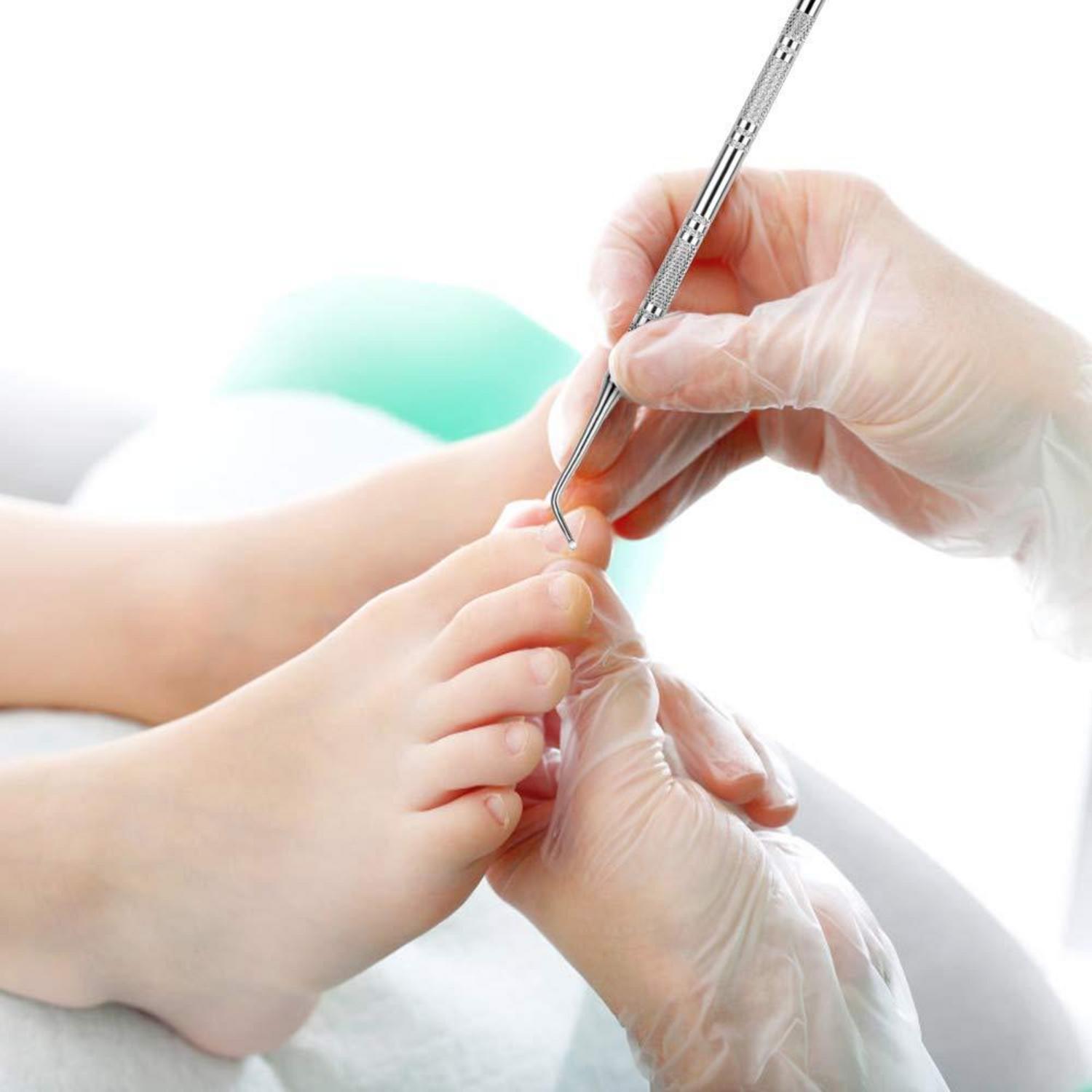 Eckenheber Nagelfeile Set Edelstahl Fußpflege Maniküre Pediküre