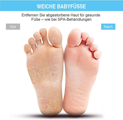 Fußbürste Fußwäscher Massage Pad Peeling Rutschfest Saugnäpfe - 28 x 28 cm