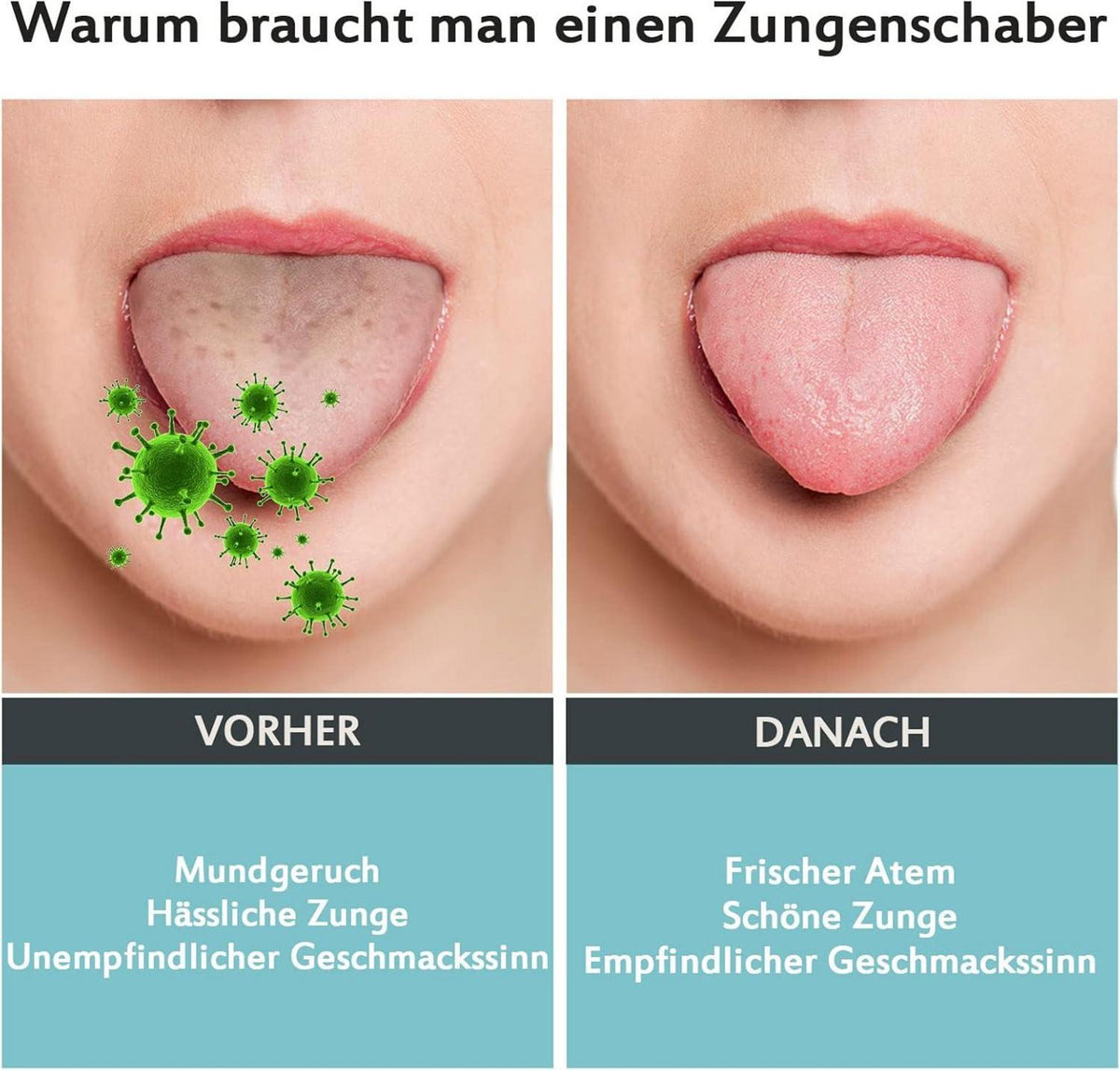Zungenschaber Edelstahl - Zungenreiniger gegen Mundgeruch