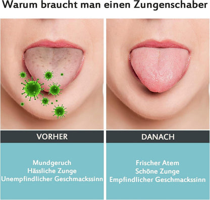 Zungenschaber Edelstahl - Zungenreiniger gegen Mundgeruch