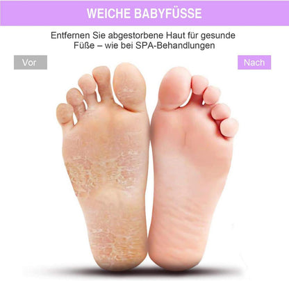 HONYIN Großes Fuß-Massagepad für Dusche & Bad mit Saugnäpfen 28x28 cm