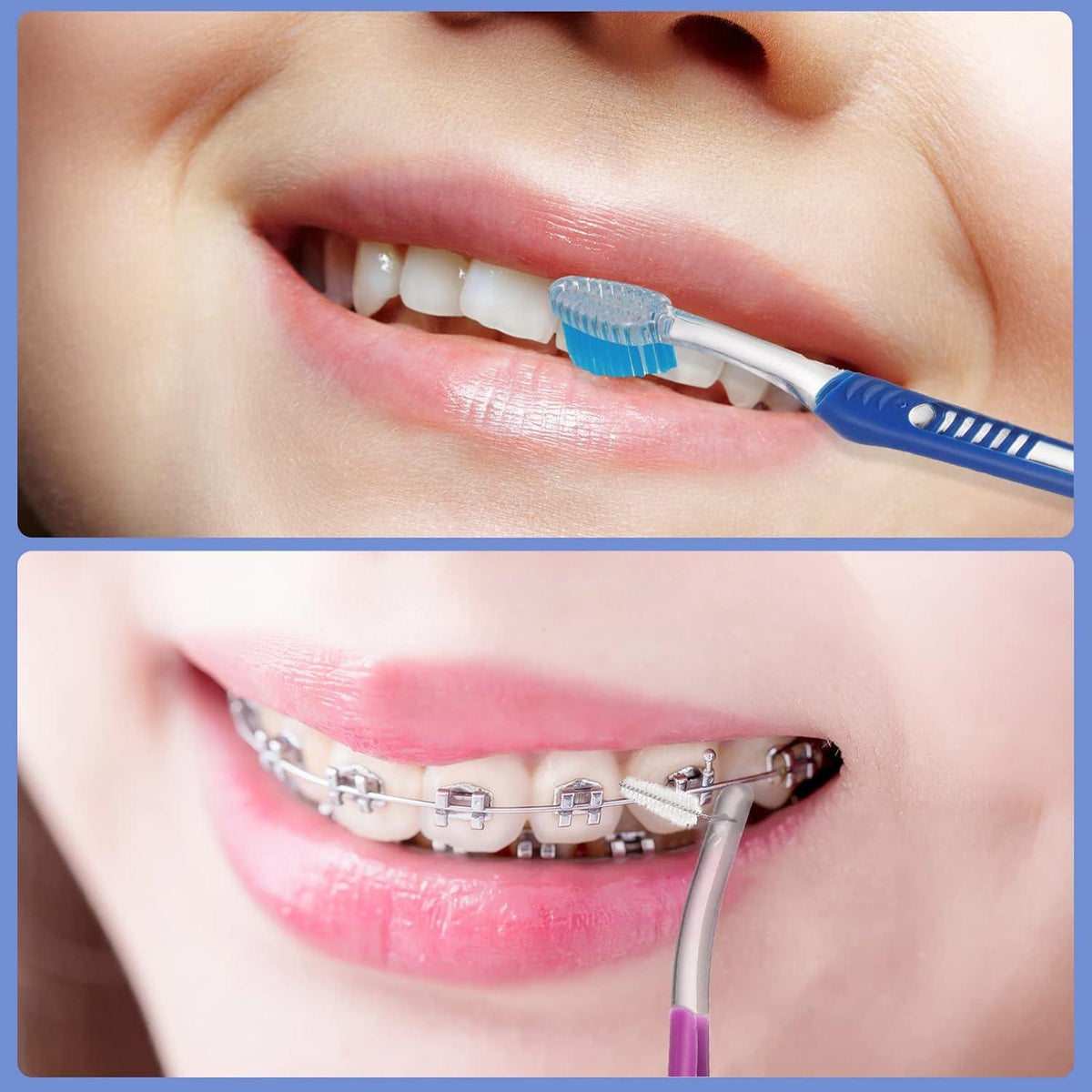 6er Pack Kieferorthopädische V-Trimm Interdental Zahnbürste Set