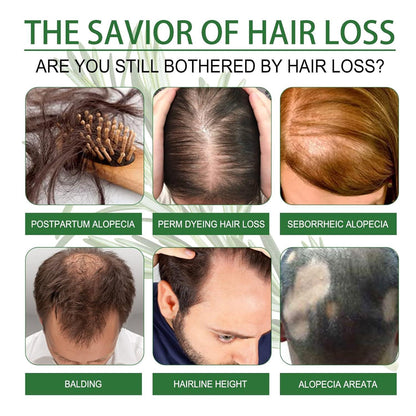 Rosmarinöl Haare 60ml Ätherisches Öl Wachstum für Haare