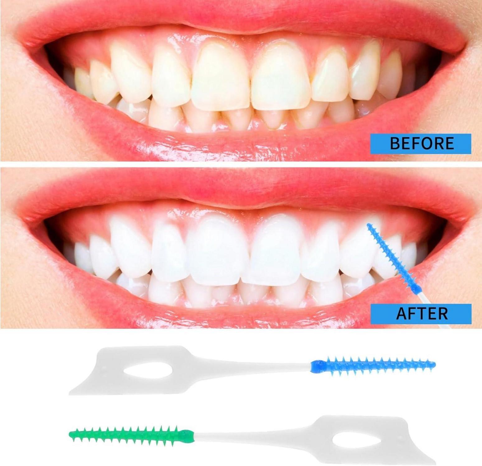 200 Stück Interdentalbürsten Silikon mit Box und Zahnseide Stick Blau Grün