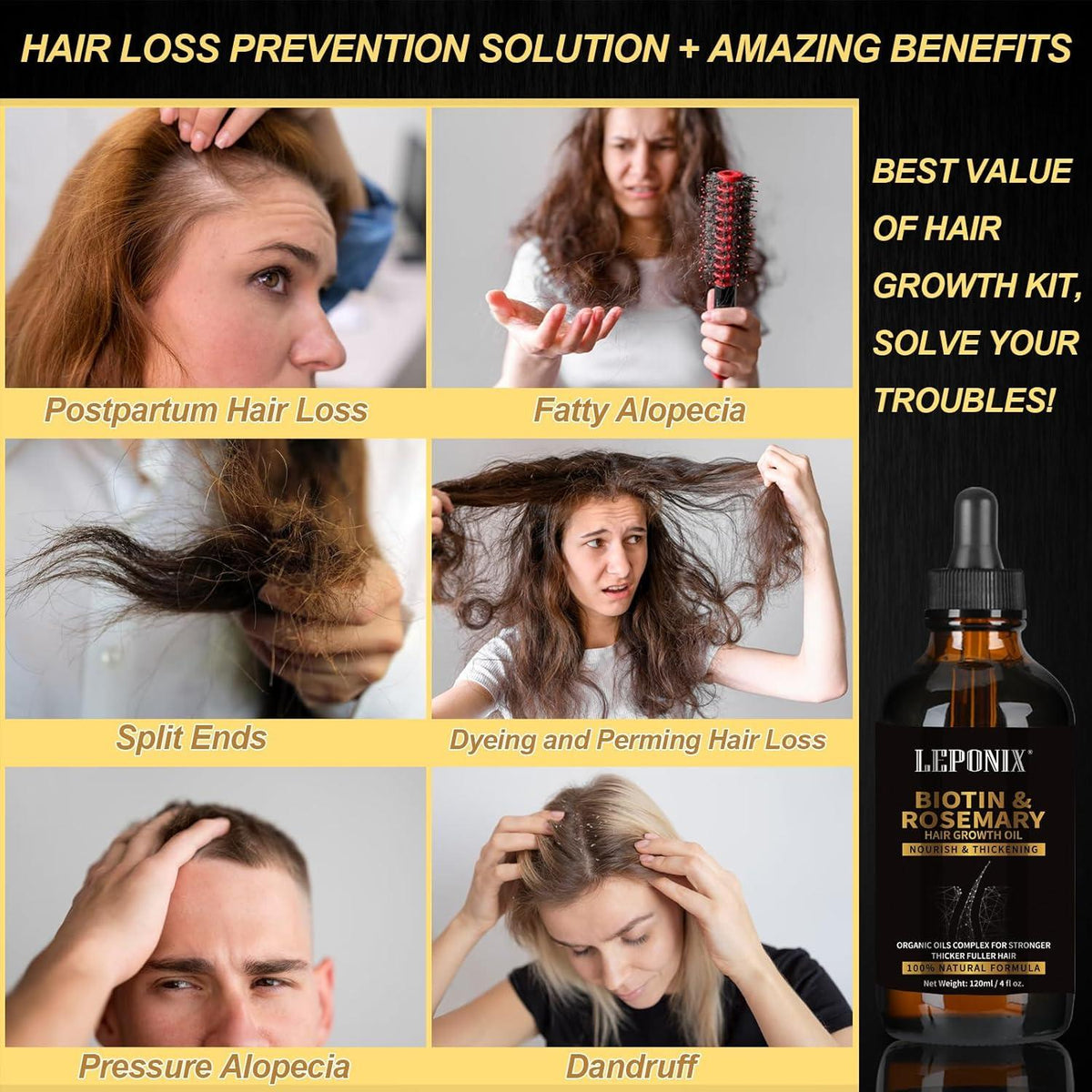Rosmarinöl Haarwachstum Set Haarausfall Männer Frauen Hair Growth Oil