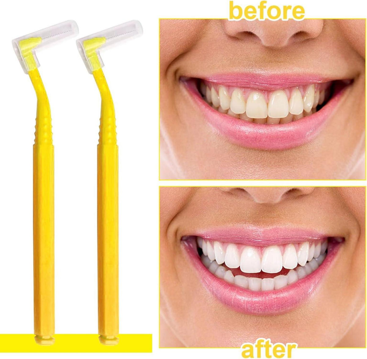 40x Gelbe Interdentalbürsten Zahnreinigung Zwischenräume Dentalbürsten