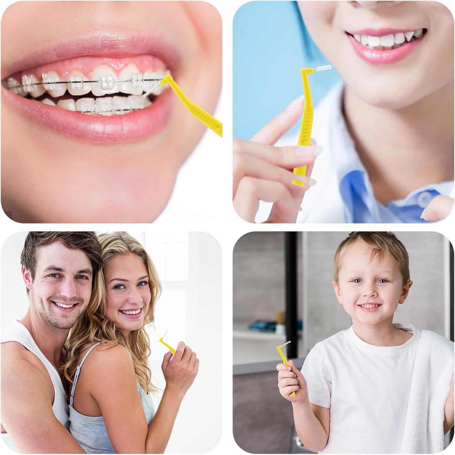 25er Pack Interdentalbürsten 0,6mm Gelb Zahnzwischenräumbürsten