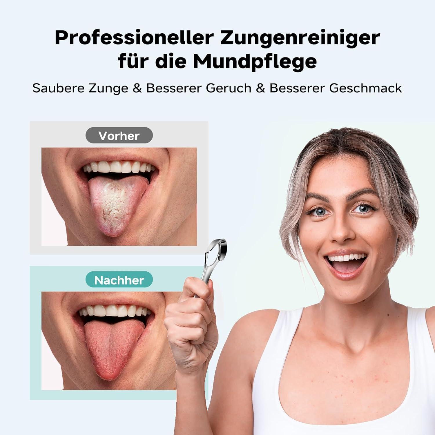 Zungenreiniger Edelstahl Tongue Scraper Mundhygiene 2024
