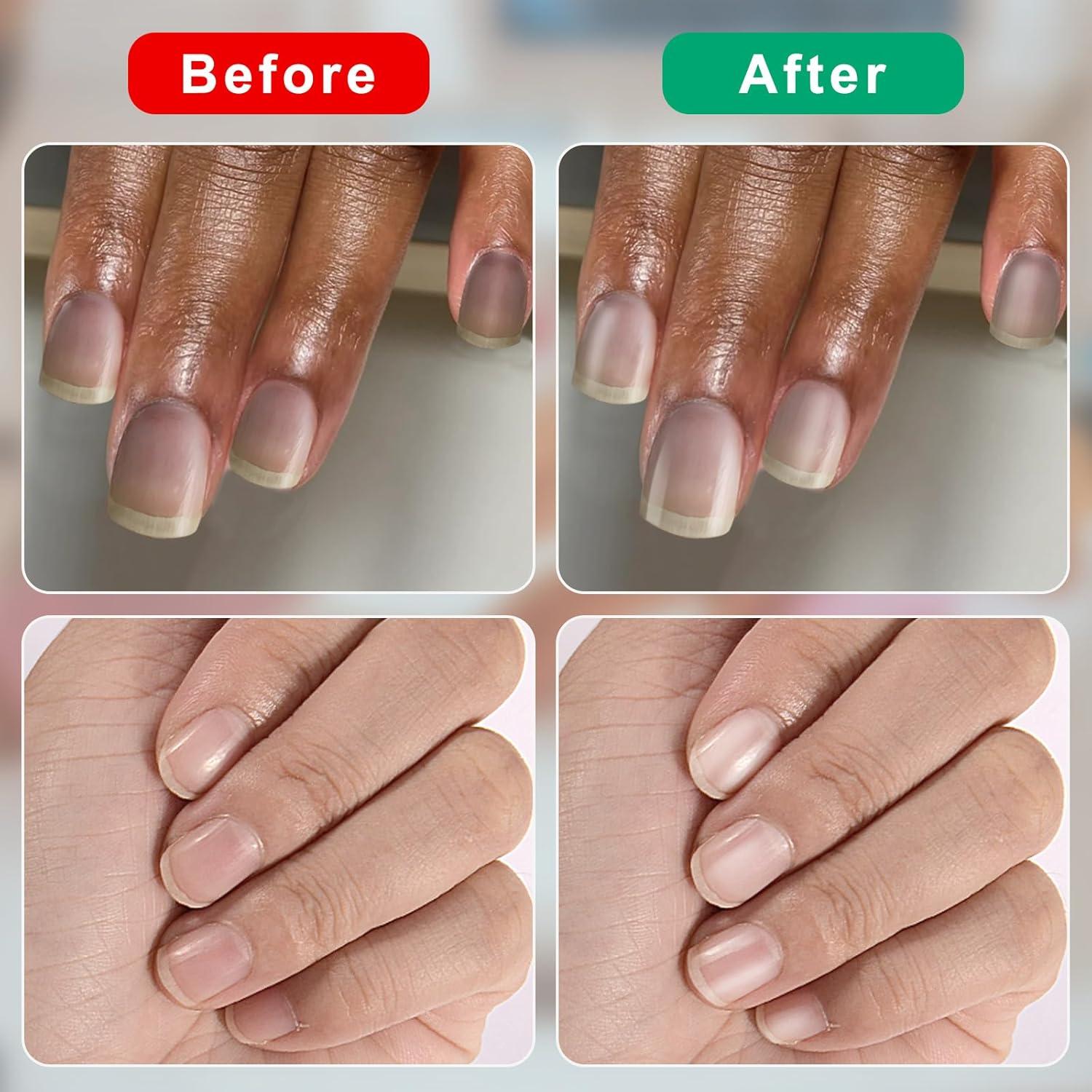 Nagelbuffer 1000/4000 Körnung Hochglanz-Polierblock Naturnägel 20