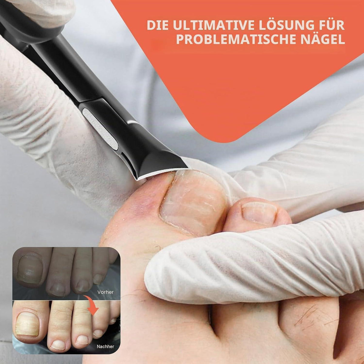 Nagelknipser für dicke Zehennägel & Fußnägel – Präzisionsschnitter